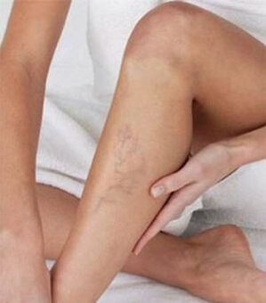 Effective treatment