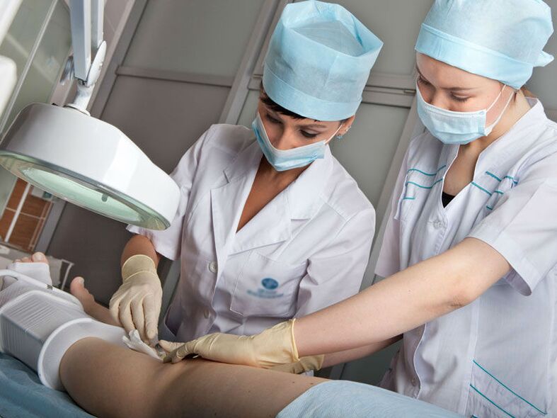 Laser ablation for varicose veins