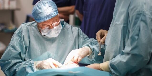 Surgical removal of varicose veins